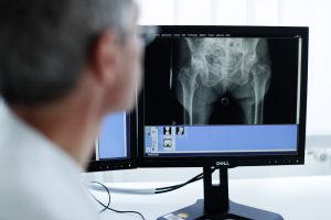 Röntgenbild Hüfte auf Bildschirm